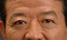 鼻梁上有横纹的人命理 鼻梁有横纹好吗