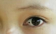 相术与健康,透过皮肤看健康