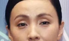 眼窝凹陷代表什么意思?