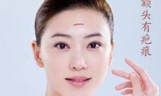 脸上有疤痕的人运势分析