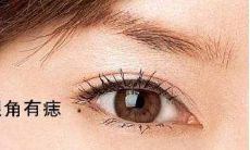 富贵的痣相特征