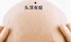 佛缘最重的痣可能会长在身体的哪些地方