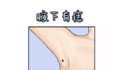 女人旺子女的痣相分析