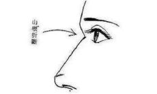 山根塌陷的女人面相分析