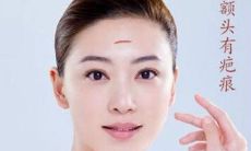 五官有疤痕的人运势分析