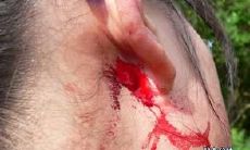 在梦中看到自己之耳流血及耳部猛涨的惊人经历