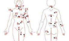 痣相是否具备真实可靠性？深入探讨人体特征在面相学中的意义与应用