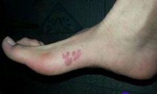 脚背长毛是福还是祸 脚背长毛的男人运气