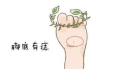 脚底长痣的人痣相分析