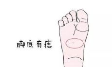 右脚底有痣代表了什么？
