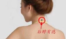 脖子有痣的人怎么样